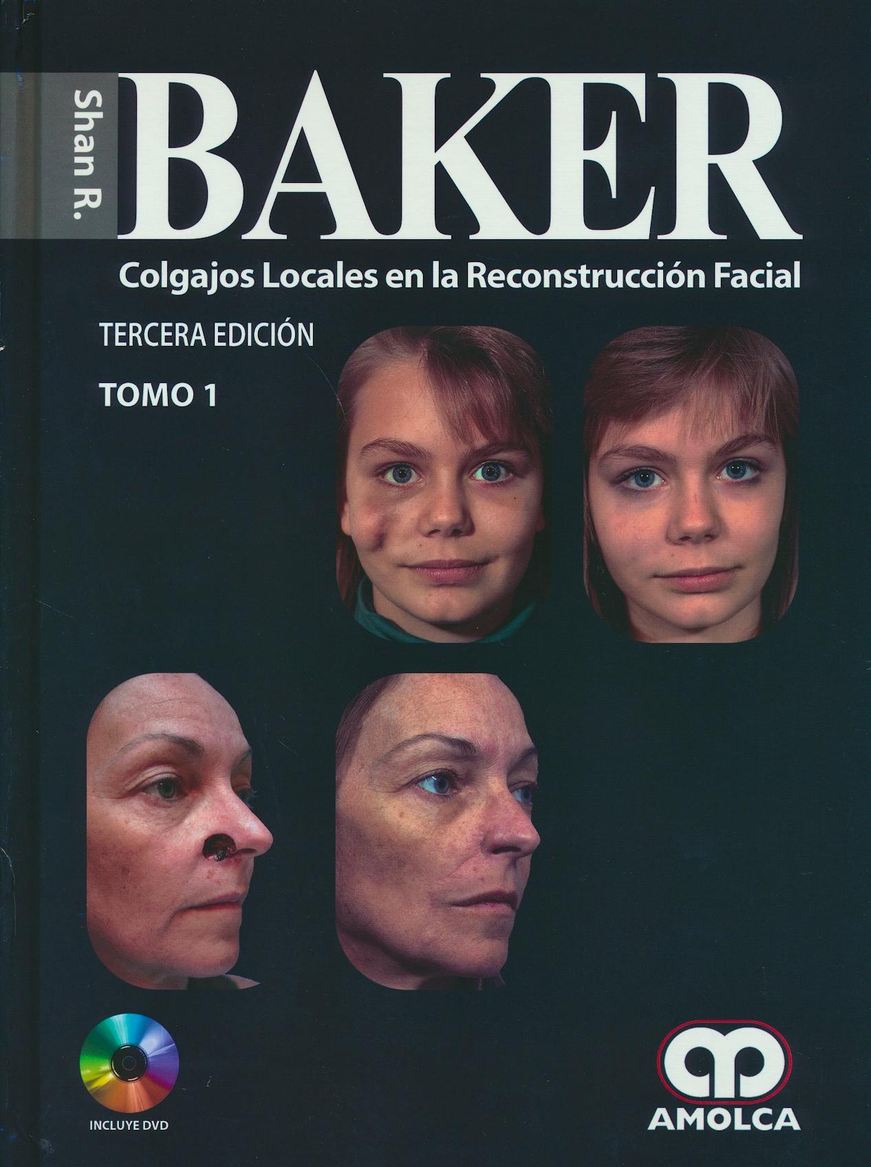 Portada del libro 9789588871752 Baker Colgajos Locales en la Reconstrucción Facial, 2 Vols.