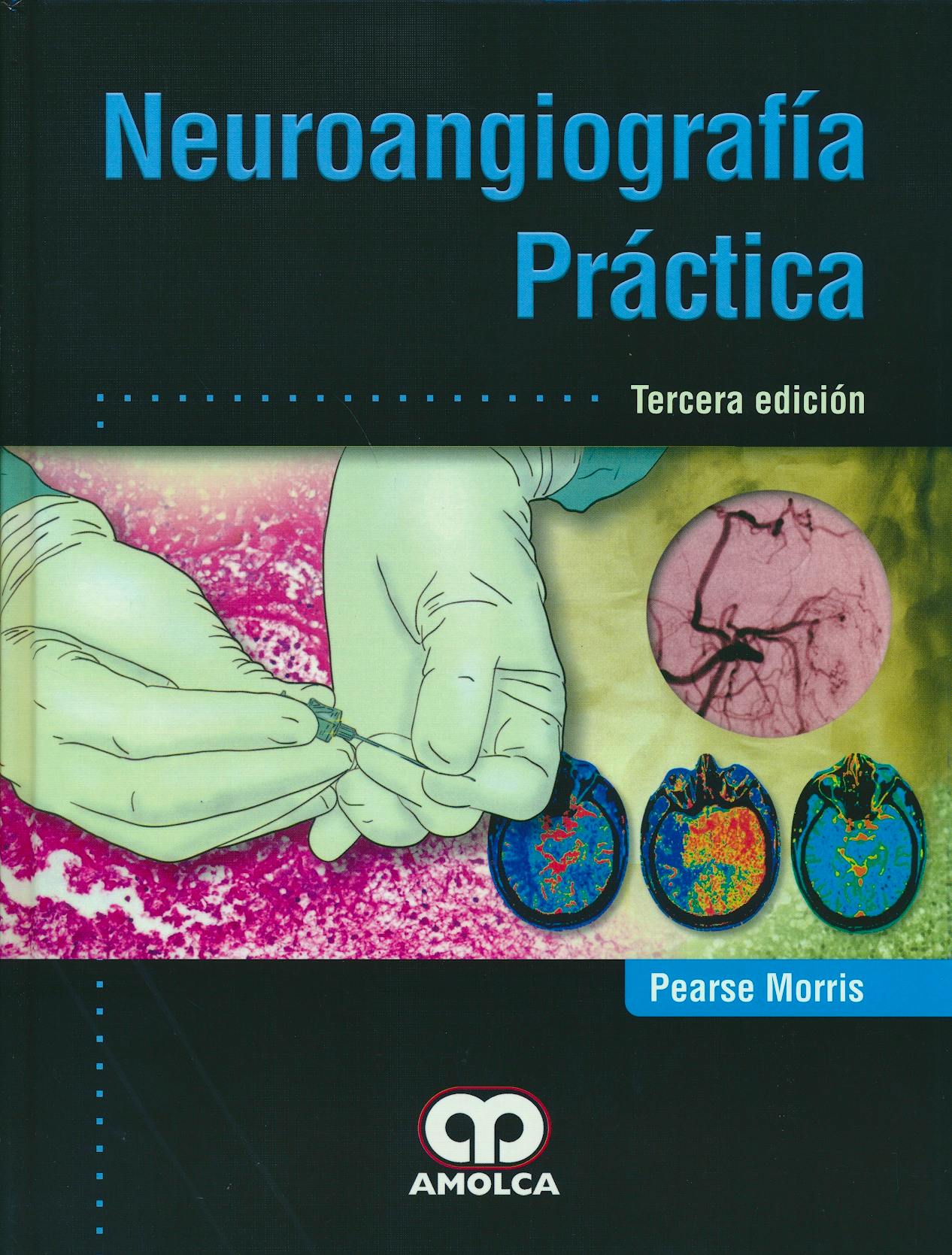 Portada del libro 9789588950044 Neuroangiografía Práctica