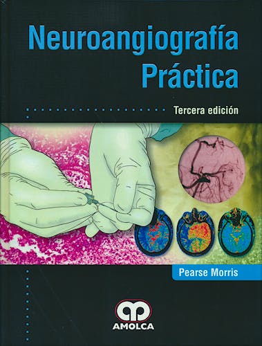 Portada del libro 9789588950044 Neuroangiografía Práctica