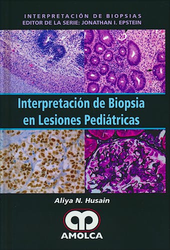 Portada del libro 9789588950068 Interpretación de Biopsia en Lesiones Pediátricas (Serie Interpretación de Biopsias)