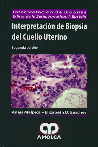 Portada del libro 9789588950075 Interpretación de Biopsia del Cuello Uterino (Interpretación de Biopsias)