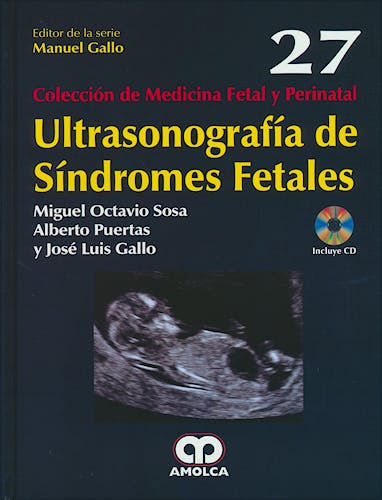 Portada del libro 9789588950099 Ultrasonografia de Sindromes Fetales (Coleccion de Medicina Fetal y Perinatal, Vol. 27) + Cd