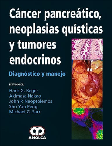 Portada del libro 9789588950129 Cancer Pancreatico, Neoplasias Quisticas y Tumores Endocrinos. Diagnostico y Manejo