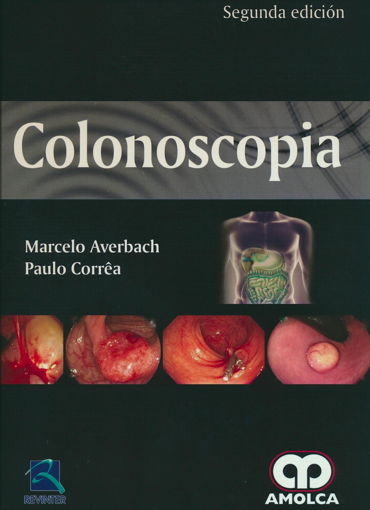 Portada del libro 9789588950136 Colonoscopia