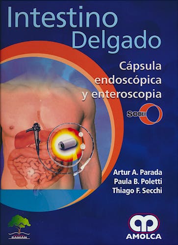 Portada del libro 9789588950198 Intestino Delgado. Capsula Endoscópica y Enteroscopia. SOBED