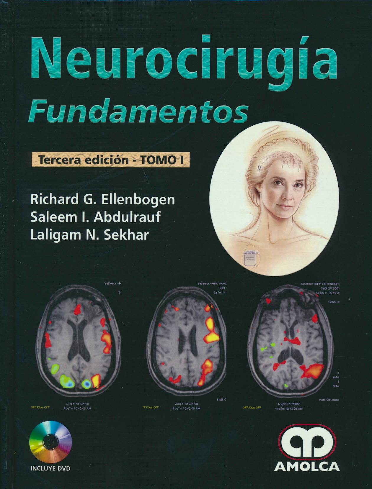 Portada del libro 9789588950204 Neurocirugía. Fundamentos, 2 Vols. + DVD