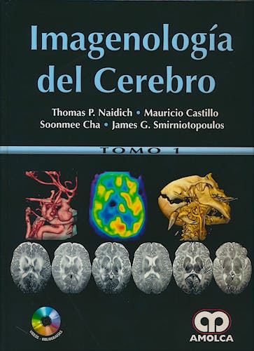 Portada del libro 9789588950280 Imagenología del Cerebro, 2 Vols.