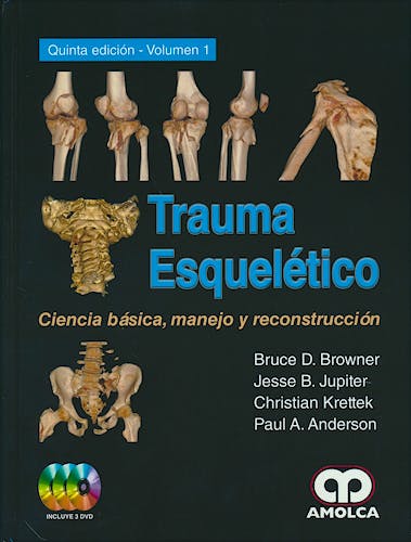 Portada del libro 9789588950365 Trauma Esqueletico. Ciencia Basica, Manejo y Reconstruccion, 2 Vols.