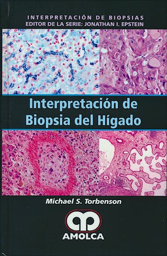Portada del libro 9789588950389 Interpretación de Biopsia del Hígado (Interpretación de Biopsias)