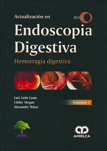 Portada del libro 9789588950396 Actualización en Endoscopia Digestiva, Vol. 1: Hemorragia Digestiva. SOBED