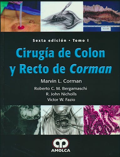 Portada del libro 9789588950419 Cirugía de Colon y Recto de Corman, 2 Vols.
