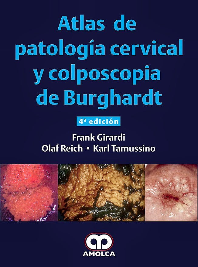 Portada del libro 9789588950556 Atlas de Patología Cervical y Colposcopia de Burghardt