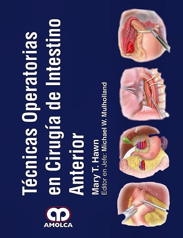 Portada del libro 9789588950822 Tecnicas Operatorias en Cirugia de Intestino Anterior