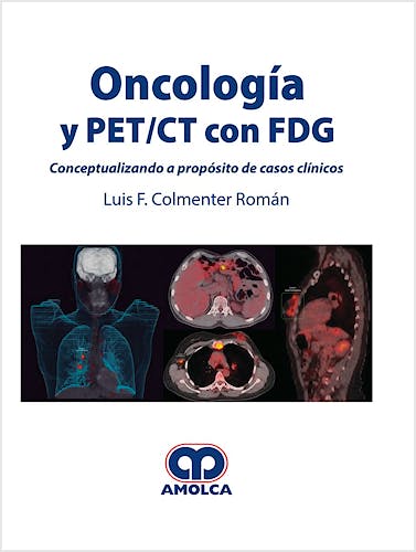Portada del libro 9789588950853 Oncología y PET/CT con FDG. Conceptualizando a Propósito de Casos Clínicos