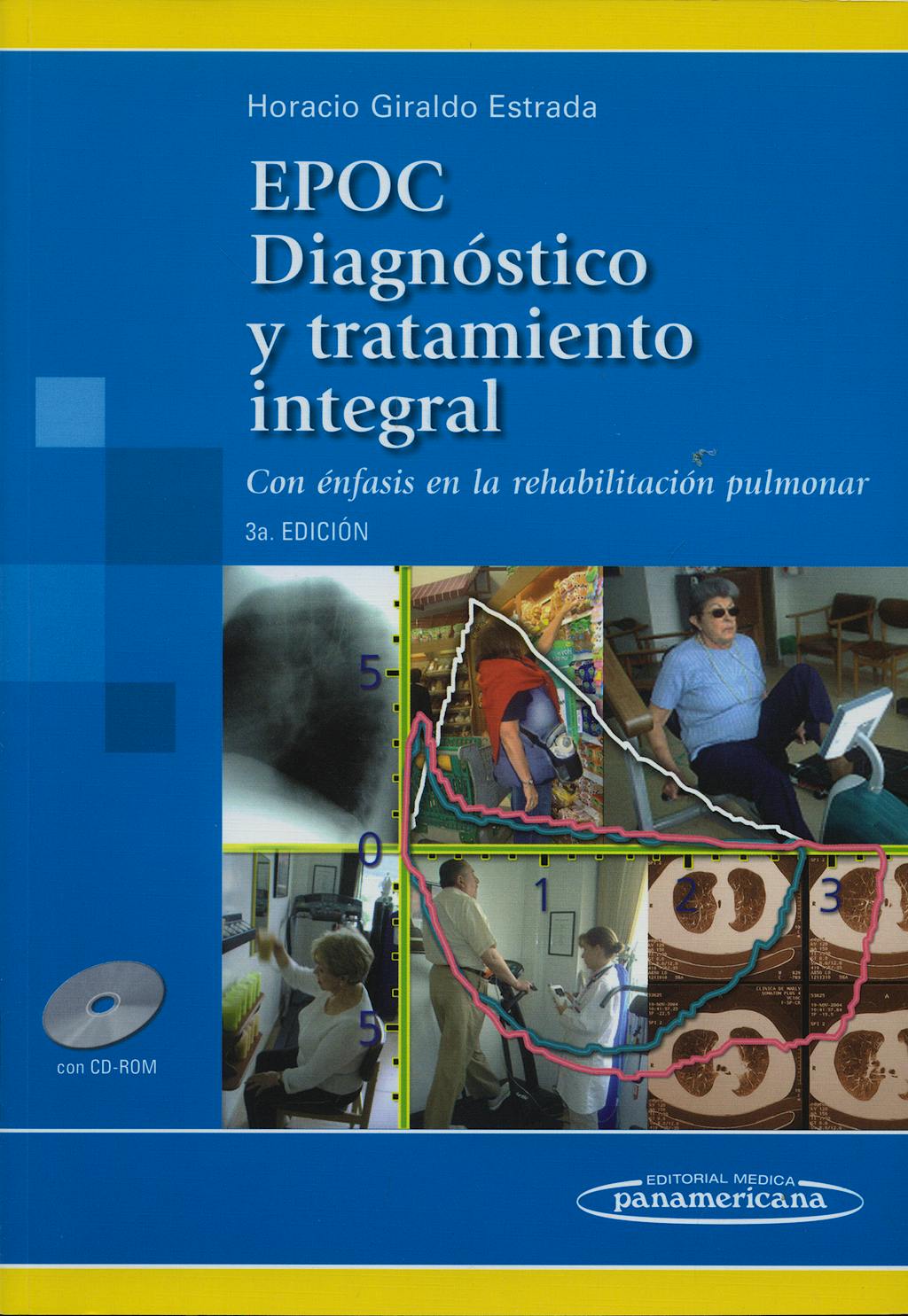 Portada del libro 9789589181973 EPOC Diagnóstico y Tratamiento Integral. Con Énfasis en la Rehabilitación Pulmonar + CD-ROM