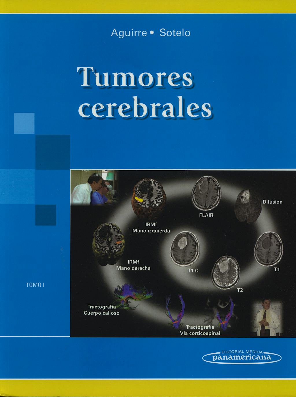 Portada del libro 9789687988849 Tumores Cerebrales, Tomo I