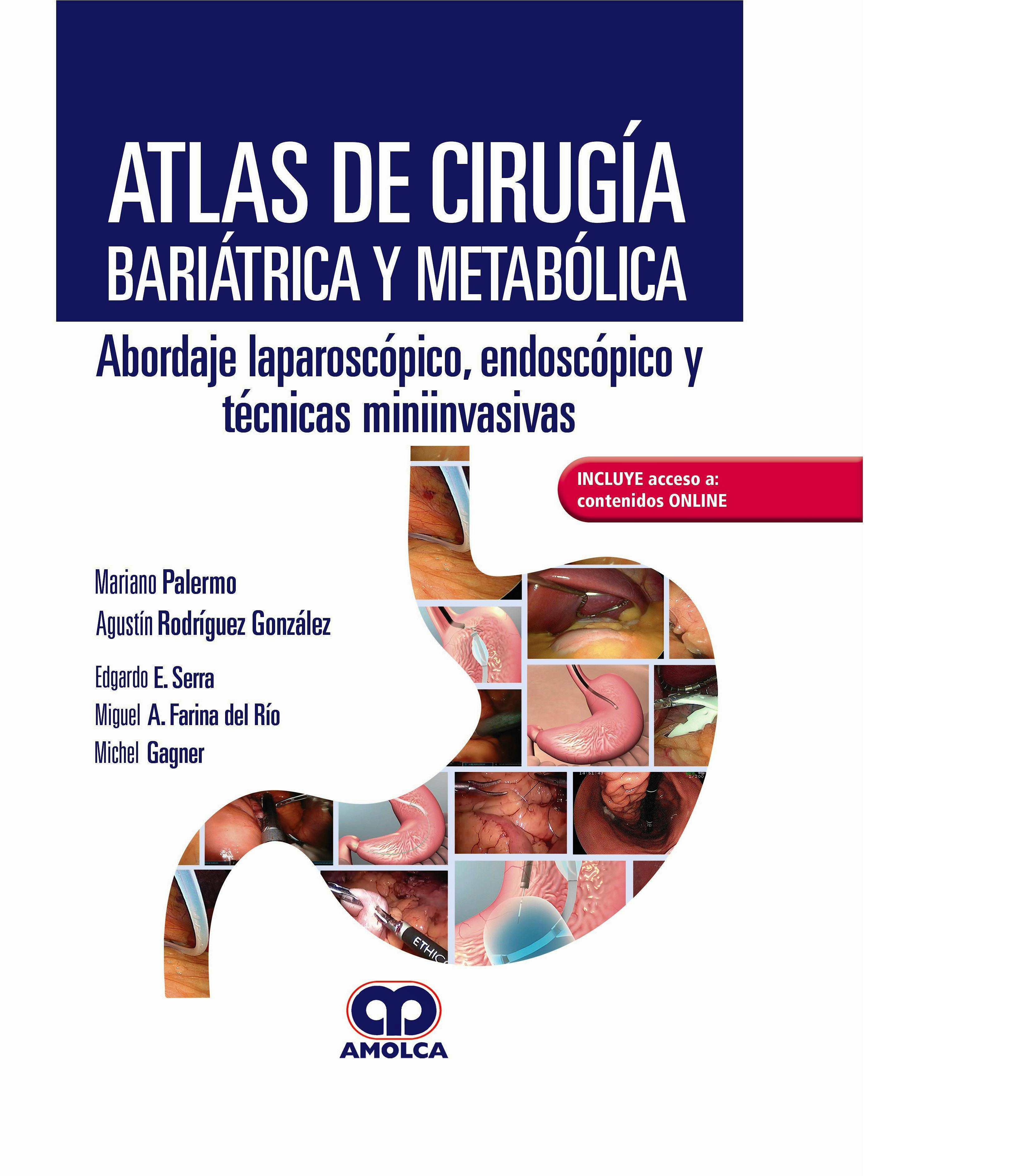 Portada del libro 9789804300066 Atlas de Cirugía Bariátrica y Metabólica. Abordaje Laparoscópico, Endoscópico y Técnicas Miniinvasivas + Acceso a Contenidos Online