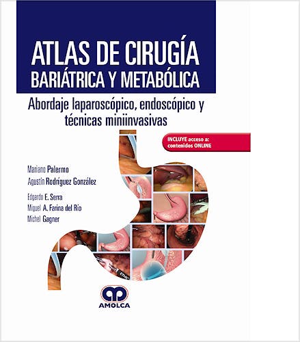 Portada del libro 9789804300066 Atlas de Cirugía Bariátrica y Metabólica. Abordaje Laparoscópico, Endoscópico y Técnicas Miniinvasivas + Acceso a Contenidos Online