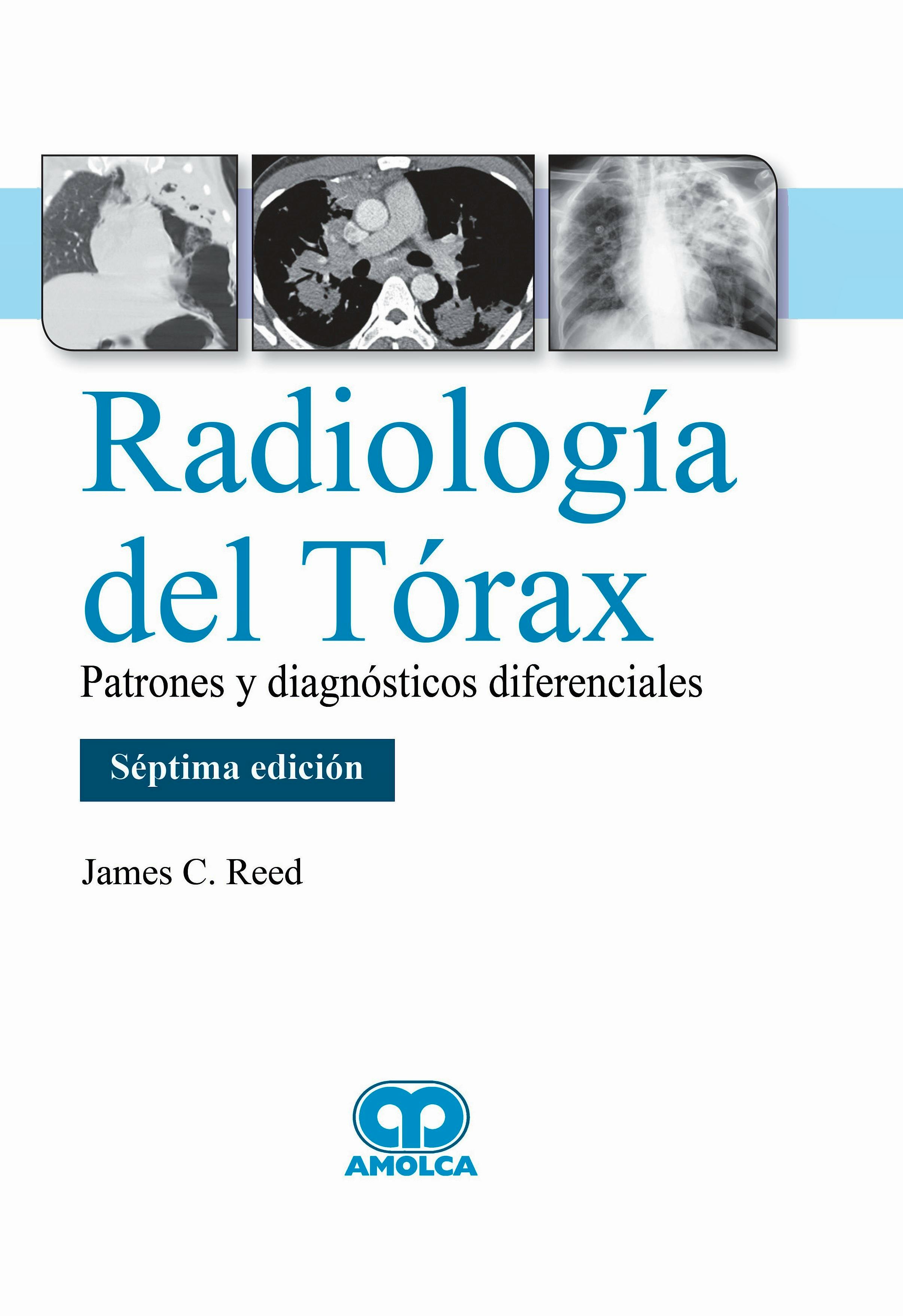 Portada del libro 9789804300097 Radiología del Tórax. Patrones y Diagnósticos Diferenciales