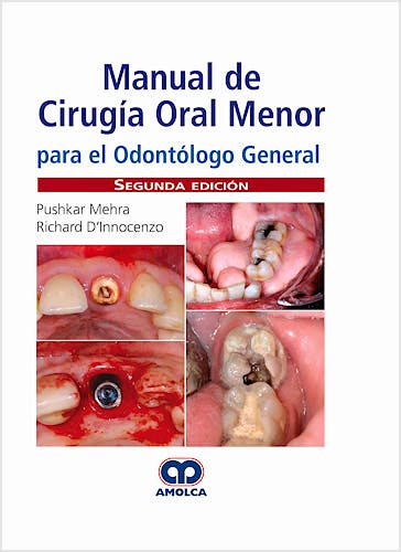 Portada del libro 9789804300349 Manual de Cirugía Oral Menor para el Odontólogo General