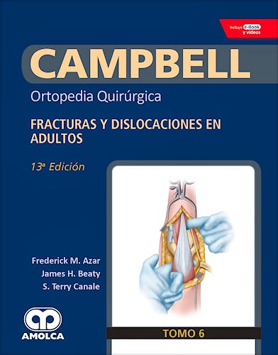 Portada del libro 9789804300608 CAMPBELL Ortopedia Quirúrgica, Tomo 6: Fracturas y Dislocaciones en Adultos