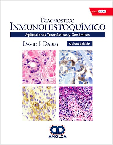 Portada del libro 9789804300707 Diagnóstico Inmunohistoquímico. Aplicaciones Teranósticas y Genóminas