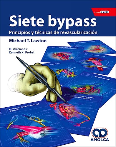 Portada del libro 9789804300813 Siete Bypass. Principios y Técnicas de Revascularización