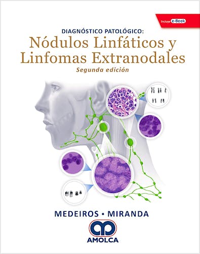 Portada del libro 9789804300851 Diagnóstico Patológico. Nódulos Linfáticos y Linfomas Extranodales