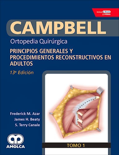 Portada del libro 9789804300882 CAMPBELL Ortopedia Quirúrgica, Tomo 1: Principios Generales y Procedimientos Reconstructivos en Adultos