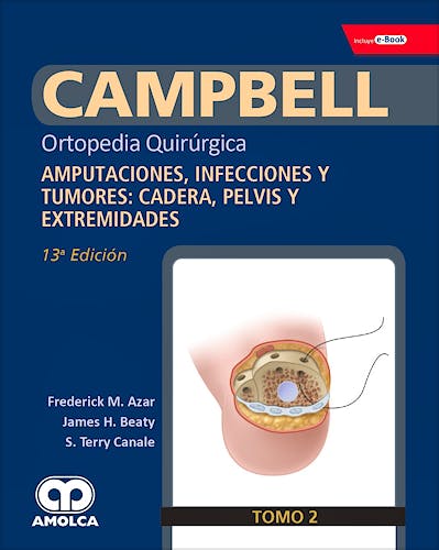 Portada del libro 9789804300905 CAMPBELL Ortopedia Quirúrgica, Tomo 2: Amputaciones, Infecciones y Tumores: Cadera, Pelvis y Extremidades