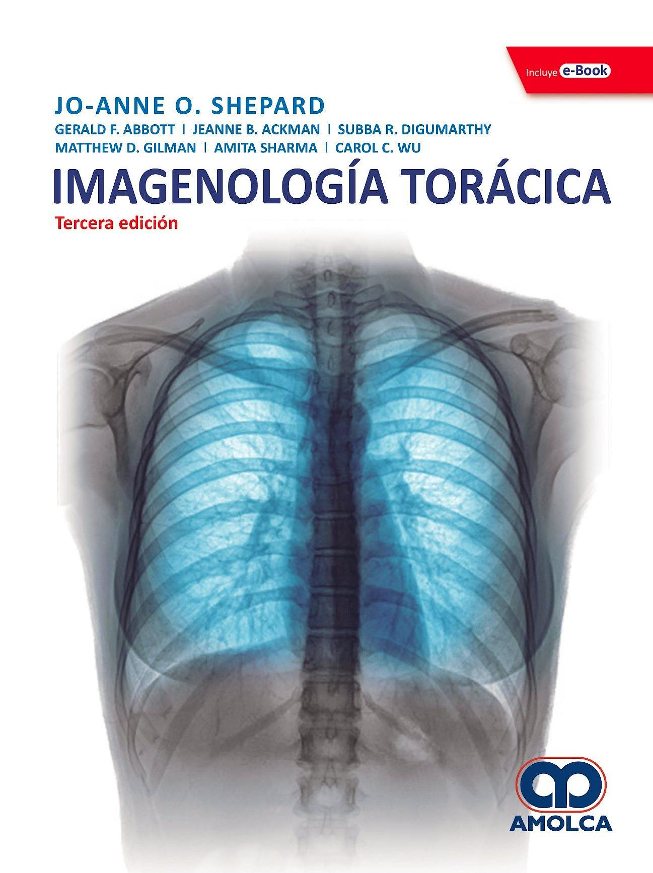 Portada del libro 9789804301018 Imagenología Torácica + E-Book