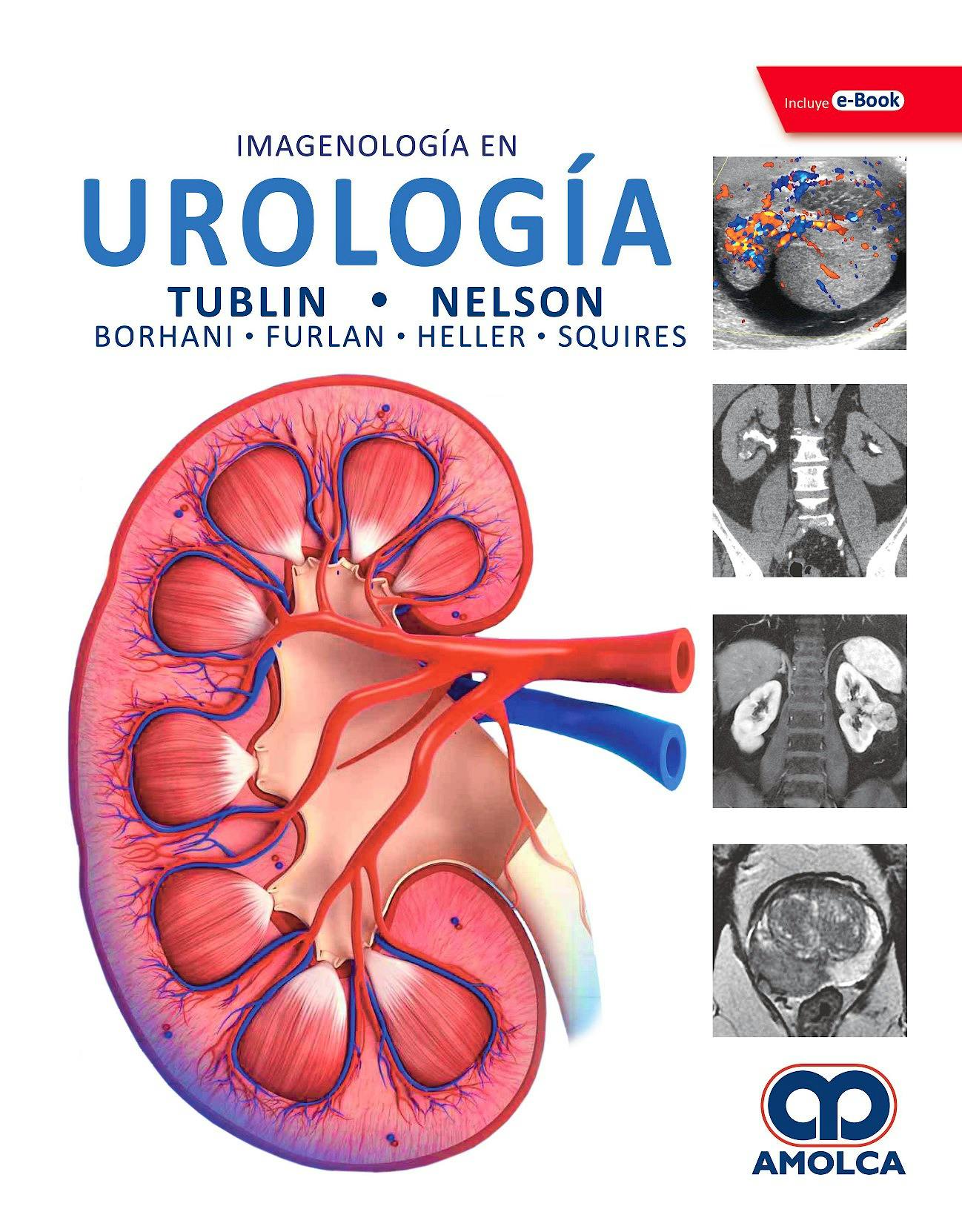 Portada del libro 9789804301087 Imagenología en Urología