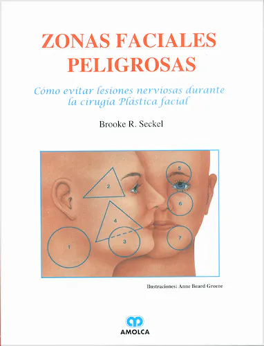 Portada del libro 9789806184596 Zonas Faciales Peligrosas. Cómo Evitar Lesiones Nerviosas Durante la Cirugía Plástica Facial