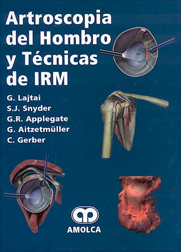 Portada del libro 9789806574076 Artroscopia del Hombro y Técnicas de IRM