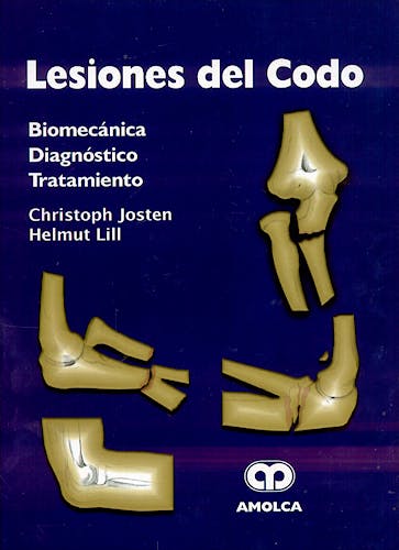 Portada del libro 9789806574106 Lesiones del Codo. Biomecanica, Diagnostico, Tratamiento