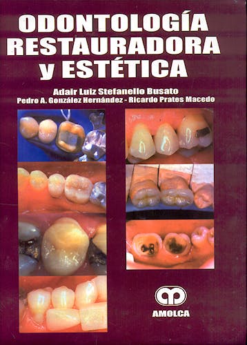 Portada del libro 9789806574144 Odontología Restauradora y Estética