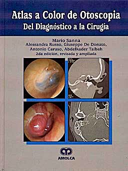 Portada del libro 9789806574151 Atlas a Color de Otoscopia. Del Diagnóstico a la Cirugía