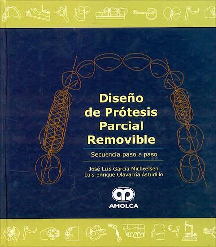 Portada del libro 9789806574403 Diseño de Prótesis Parcial Removible. Secuencia Paso a Paso