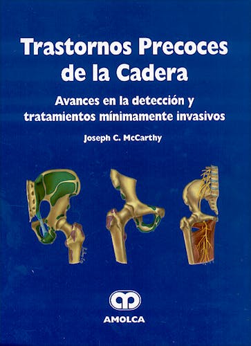 Portada del libro 9789806574434 Trastornos Precoces de la Cadera. Avances en la Detección y Tratamientos Mínimamente Invasivos