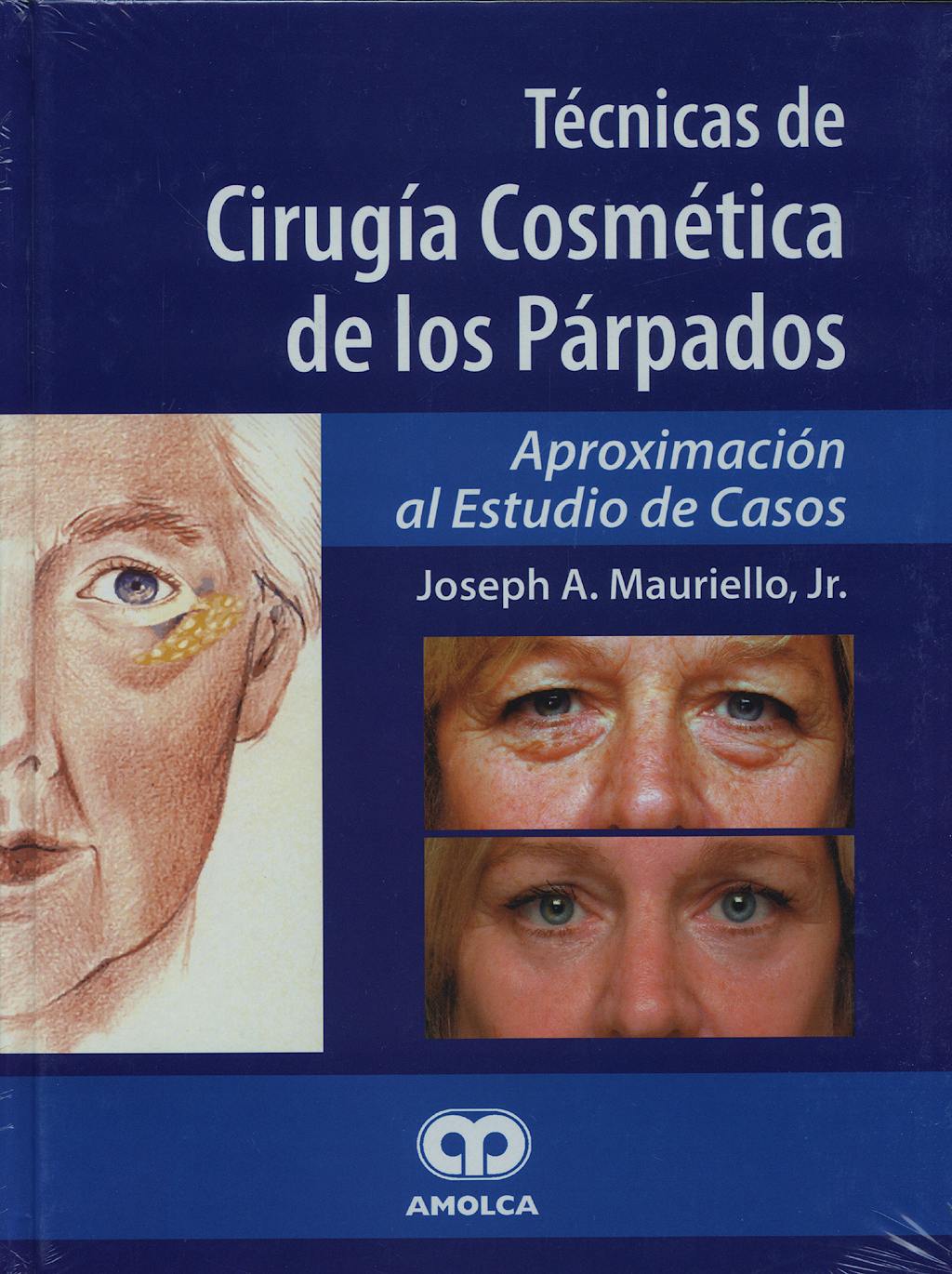 Portada del libro 9789806574458 Técnicas de Cirugía Cosmética de los Párpados. Aproximación al Estudio de Casos