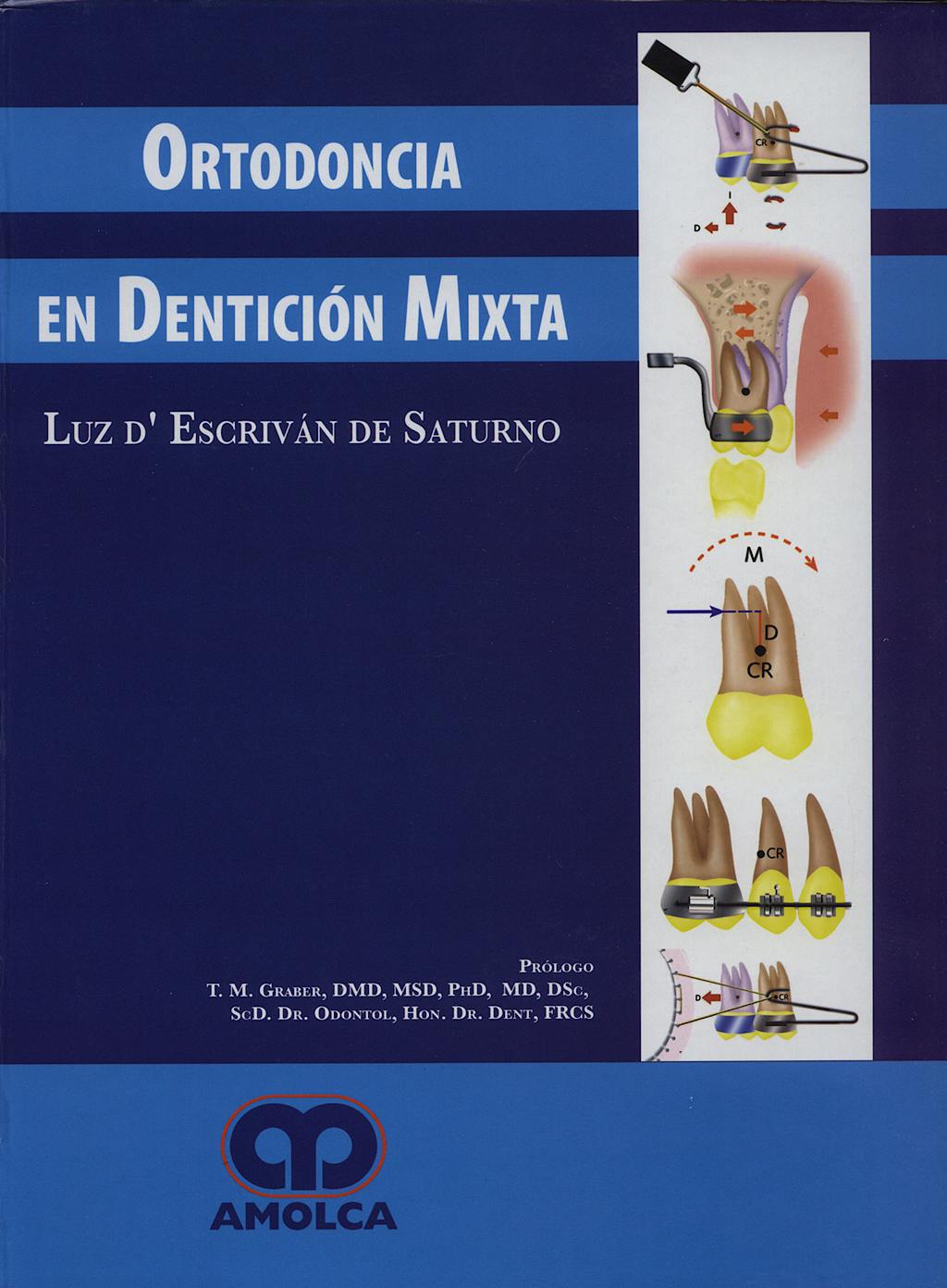 Portada del libro 9789806574472 Ortodoncia en Dentición Mixta