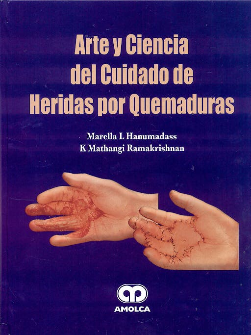 Portada del libro 9789806574519 Arte y Ciencia del Cuidado de Heridas por Quemaduras