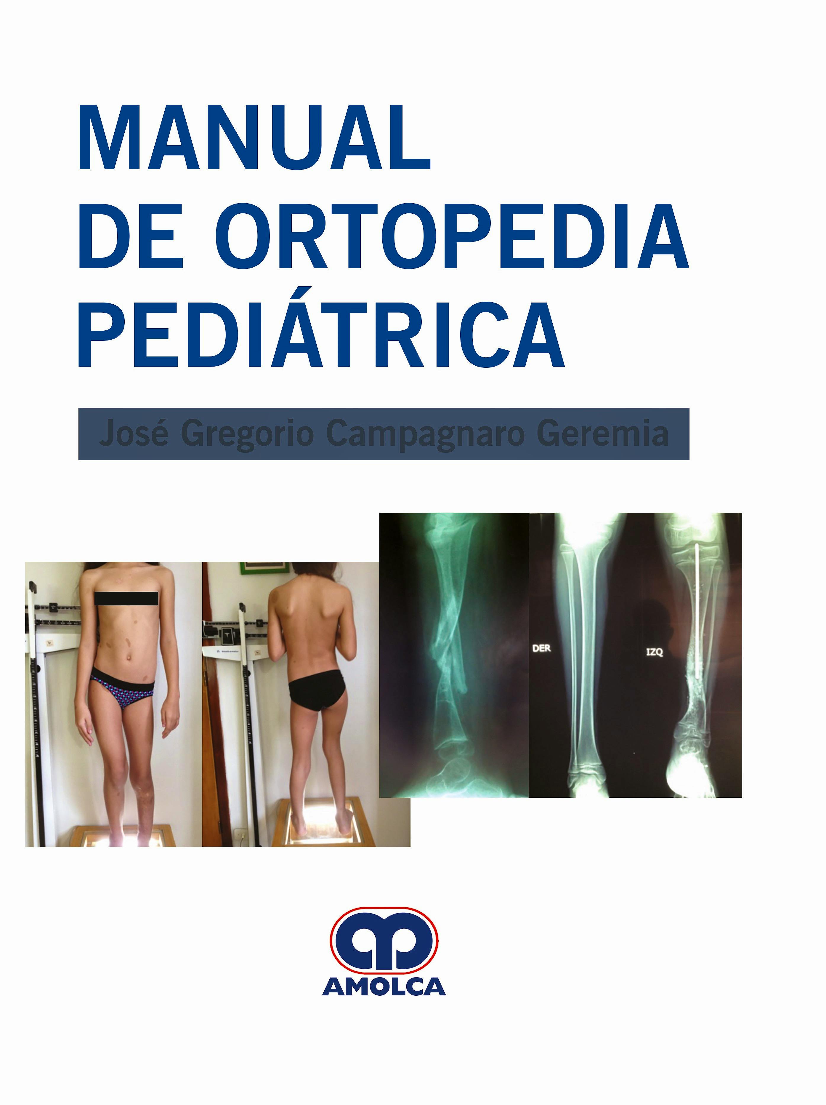 Portada del libro 9789806574885 Manual de Ortopedia Pediátrica