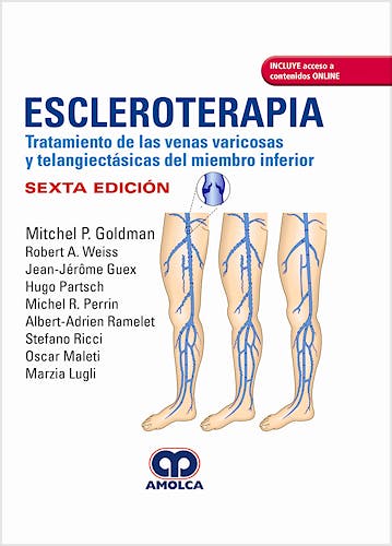 Portada del libro 9789806574922 Escleroterapia. Tratamiento de las Venas Varicosas y Telangiectásicas del Miembro Inferior + Acceso a Contenidos Online