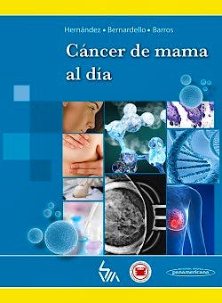Portada del libro 9789806908482 Cáncer de Mama al Día (E-Book Online)