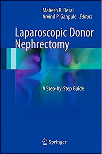 Portada del libro 9789811028472 Laparoscopic Donor Nephrectomy. a Step-by-Step Guide