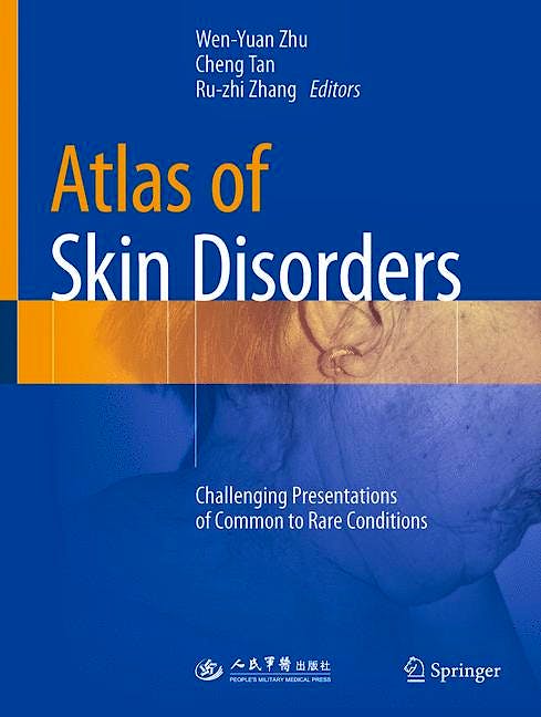 Portada del libro 9789811080364 Atlas of Skin Disorders. Challenging Presentations of Common to Rare Conditions