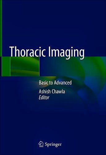 Portada del libro 9789811325434 Thoracic Imaging. Basic to Advanced