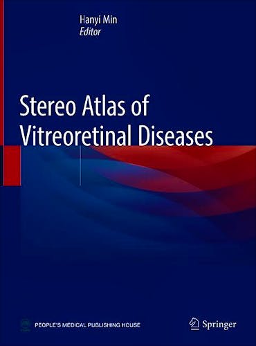 Portada del libro 9789811383984 Stereo Atlas of Vitreoretinal Diseases