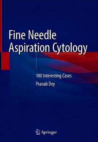 Portada del libro 9789811397714 Fine Needle Aspiration Cytology. 100 Interesting Cases